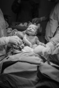 A newborn baby in a hospital delivery room, surrounded by medical practitioners during childbirth.