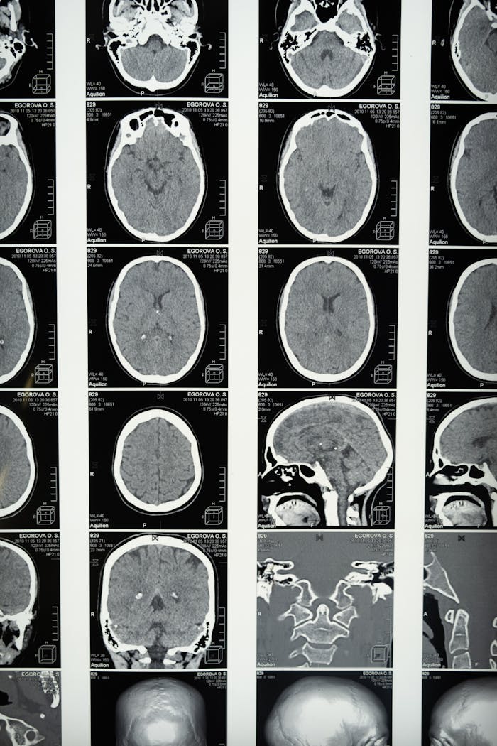 Comprehensive set of brain MRI scans highlighting cranial anatomy for medical use.